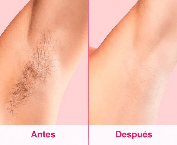 SKINUP Piel de Diosa